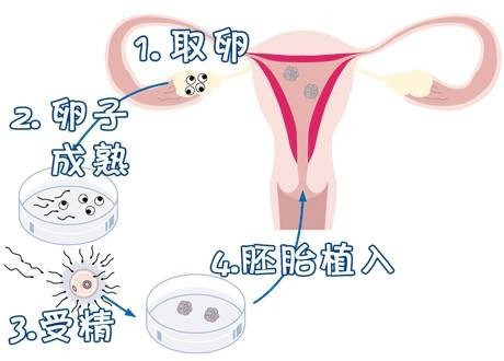 遗传阻断案例